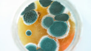 Mold being tested under a microscope: what is the cost of mold removal in brockton?